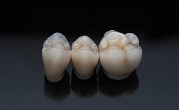 Zirconia Digitale